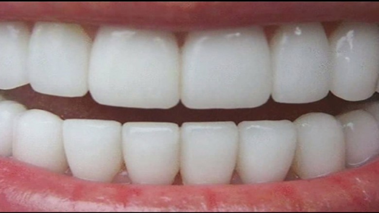 Białe zęby - rzecz bardzo trudna do osiągnięcia